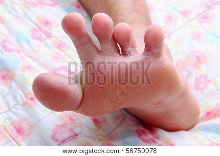 Foot