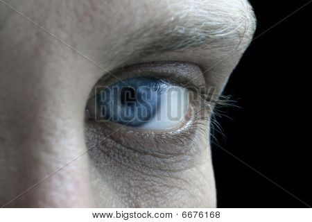 Blue Eye