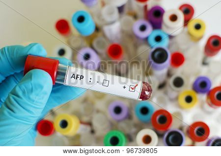 AFP positive