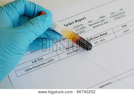 AFP result
