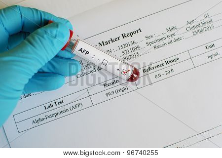 AFP result