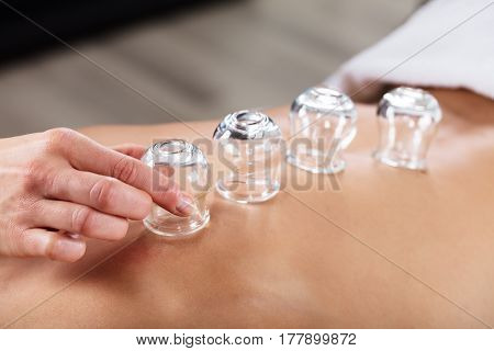 Therapist Placing Transparent Glass Cups On Person's Back In Spa