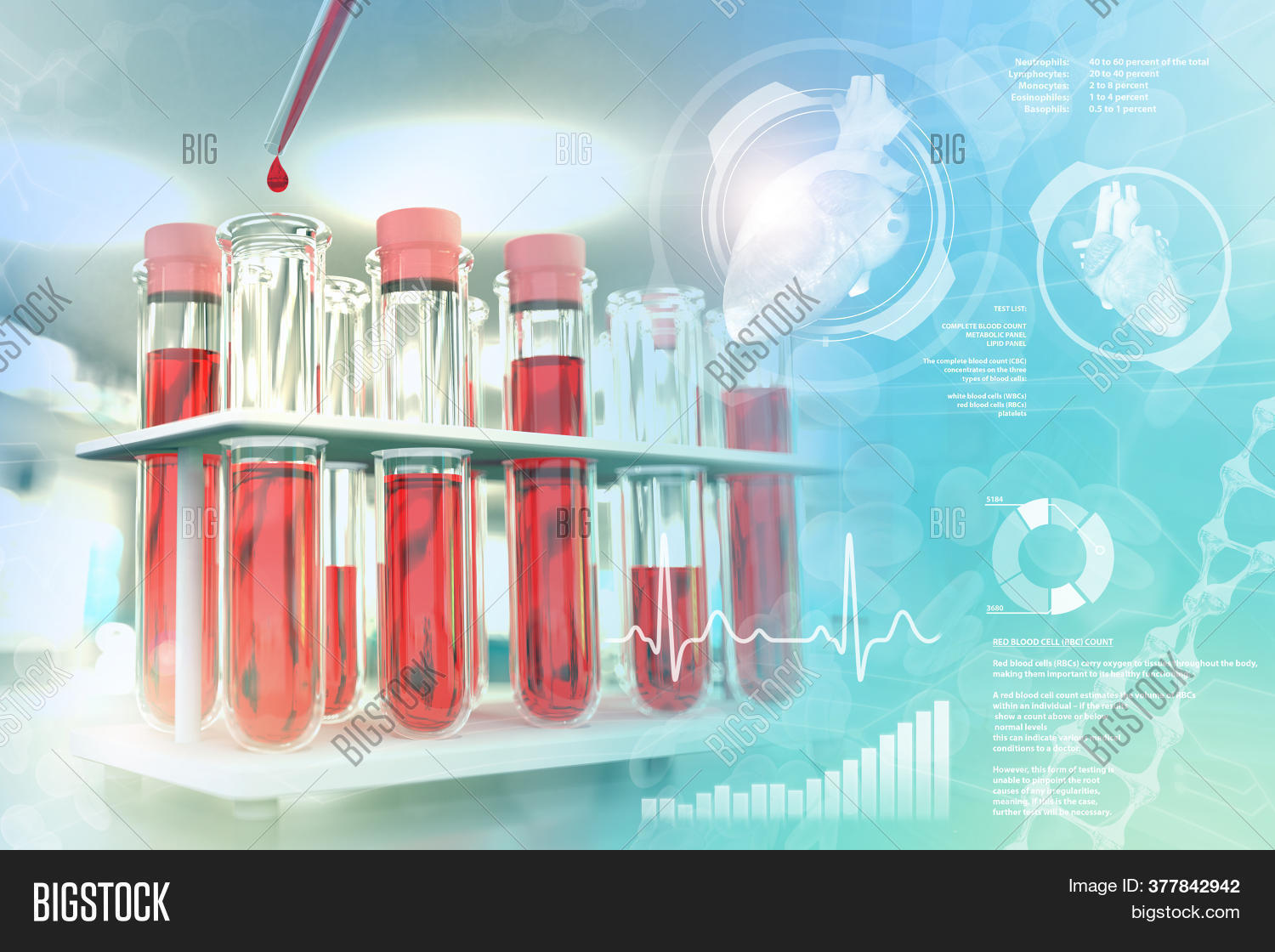 bigstock