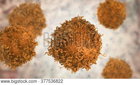 Stomach Cancer Cells, 3d Illustration Showing Morphology Of Cancerous Cells