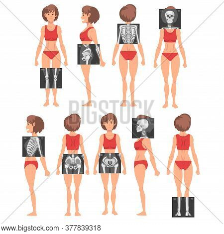 X-ray Examination Vector Set. Young Woman Being Examined In The Hospital