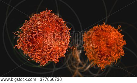 Stomach Cancer Cells, 3d Illustration Showing Morphology Of Cancerous Cells
