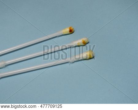 Dirty Cotton Swabs. Earwax On Cotton Swabs. Personal Hygiene. Dirt From The Ears. Medicine. Hygiene 