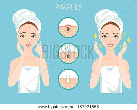 Troubled woman with female facial skin problem needs to care about: infographic of pimples and stages of their treatment and clearance.