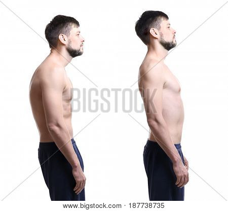 Rehabilitation concept. Collage of man with poor and good posture on white background