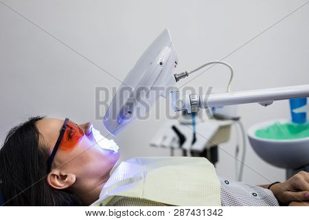 Teeth Whitening On Lamp Ultravioleta. The Girl On Reception At The Dentist For Teeth Whitening. The