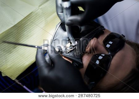 Modern Dental Equipment. Dentist Treats Tooth Decay In The Teeth With A Dental Drill, Saliva Ejector