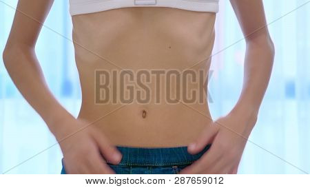 Anorexia Concept - Slim Teen Girl, With Protruding Ribs Looking At Her Reflection In The Mirror