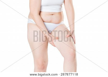 Overweight Woman With Fat Thighs, Obesity Female Legs Isolated On White Background, Weight Loss Conc