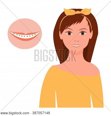 Portrait Of Pretty Woman Smiling With Braces Isolated On White Background Stock Vector Illustration.