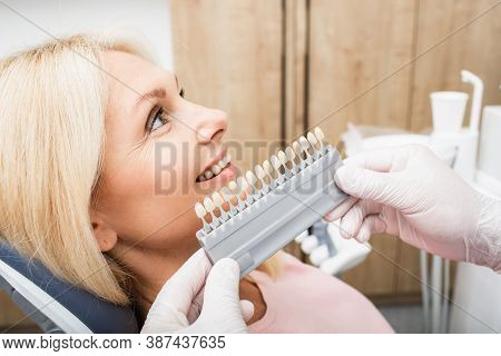 Teeth Palette With Different Shades Of Teeth Near Female Smiling. Stomatology, Whitening Teeth, Toot