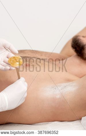 Depilation And Epilation Male Armpit With Liquid Sugar Paste By Spatula. Hand Of Cosmetologist Apply
