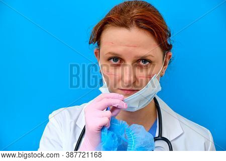 Nurse With Red Eyes Removes The Mask From His Face After Work And Shows The Wounds Rubbed With Prote