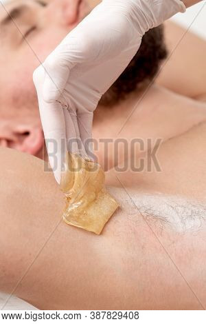 Depilation And Epilation Male Armpit With Liquid Sugar Paste. Hand Of Cosmetologist Applying Wax Pas