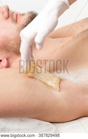 Depilation And Epilation Male Armpit With Liquid Sugar Paste. Hand Of Cosmetologist Applying Wax Pas