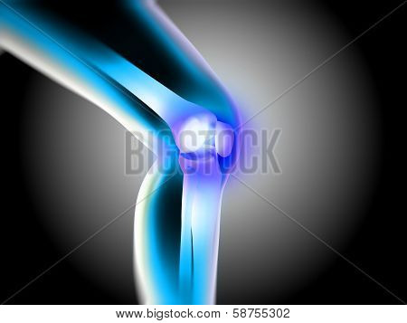 x ray of knee showing knee pain