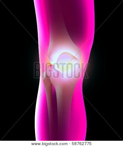illustration of a painful knee