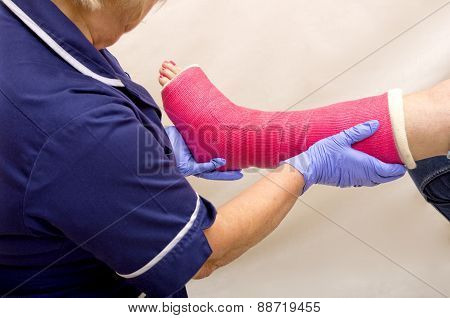 Ladies leg in Cast being treated by a Nurse
