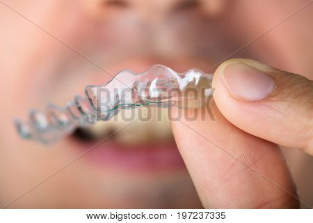 Cropped image of man holding transparent teeth aligners