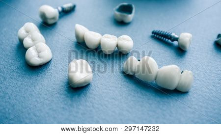 Surgical Orthodontics. Teeth Reconstruction And Prosthodontics. Closeup Of Dental Implants And Ceram