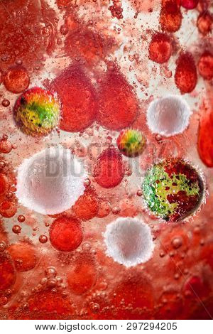 Meningitis Bacteria Infection