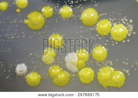 Bacteria Grown From Skin Smear, Colonies Of Micrococcus Luteus And Staphylococcus Epidermidis On Pet