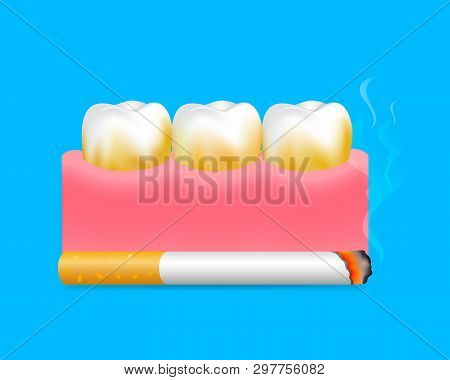 Teeth With Cigarette. Smoking Effect On Human Teeth. Dental Care Concept. Stop Smoking, World No Tob