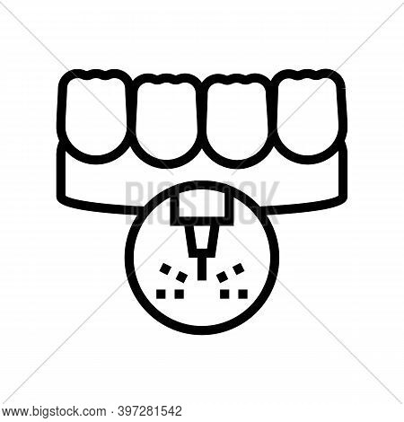 Stomatology Teeth Laser Treatment Line Icon Vector. Stomatology Teeth Laser Treatment Sign. Isolated