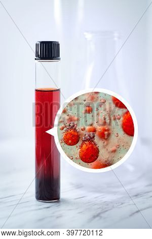 Medical Test Tube With Blood Sample For Laboratory Medical Testing And Magnification