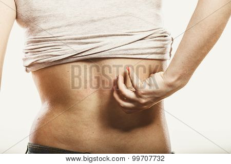 Human Scratching Itchy Back Skin. Rash.