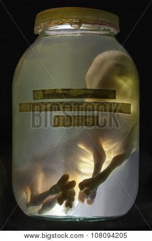 The Embryo Calf In Formaldehyde