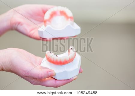 Hand holding a set of dentures