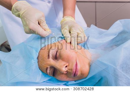 Aged Woman Doing Mesothreads And Thread Lifting, Cosmetology. Cosmetic Procedure To Eliminate Signs 