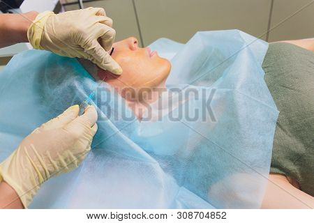 Aged Woman Doing Mesothreads And Thread Lifting, Cosmetology. Cosmetic Procedure To Eliminate Signs 