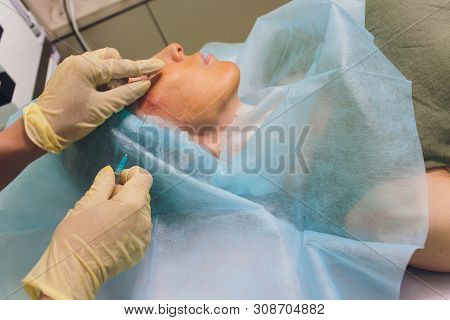 Aged Woman Doing Mesothreads And Thread Lifting, Cosmetology. Cosmetic Procedure To Eliminate Signs 