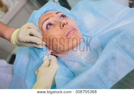 Aged Woman Doing Mesothreads And Thread Lifting, Cosmetology. Cosmetic Procedure To Eliminate Signs 