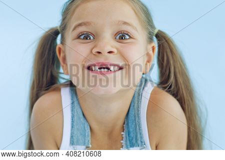 Portrait Of Preschooler Girl With Open Mouth Without Milk Tooth. High Quality Photo
