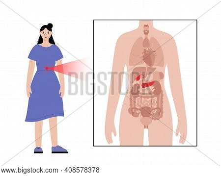 Pain Or Inflammation In Pancreas. Adult Woman Anatomy Poster. Diabetes, Ache In Female Human Body. I