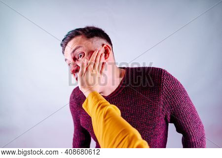 Crop Person Slapping Scared Man In Face. Emotional Male Getting Slapped In Face While Shouting With