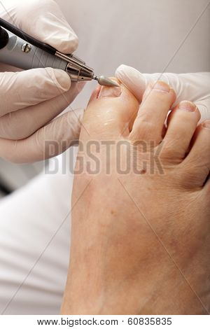 Chiropodist Polishing