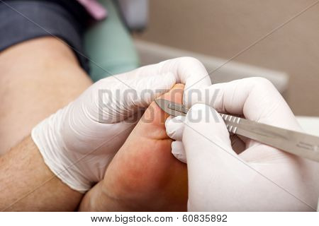 Chiropodists Working With A Scalpel