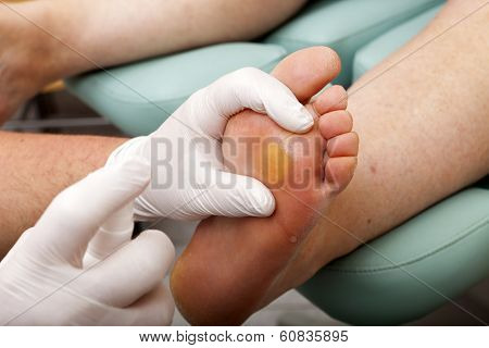 Chiropodists Cleans The Foot