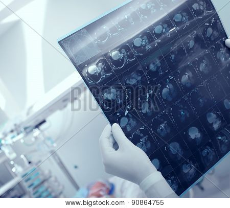 Medical Doctor Research Ct Scan Of Heavy Patient In Hospital;