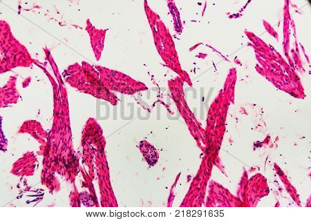 Cell Microscopic- Pyloric Division Stomach