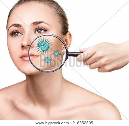 Magnifying glass with microbes on female face. Isolated on white. Causative agents of acne concept.