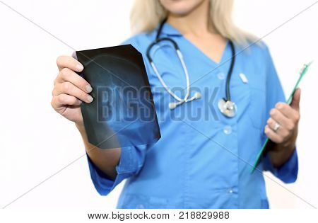 doctor holds x-ray in hands close up